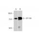 western blotting image from recommended SP-100 (1G6) monoclonal antibody replacement. Image 352144
