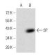 SP Antibody (4G7C3) - Western Blotting - Image 358342 