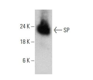 SP Antibody (4G7C3) - Western Blotting - Image 384281 