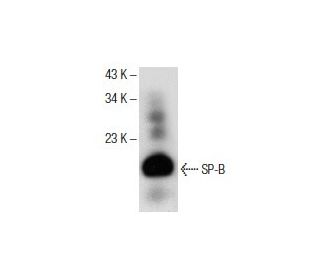 SP-B Antibody (1B9) - Western Blotting - Image 153710 