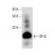 SP-B Antibody (1B9) - Western Blotting - Image 153710 