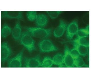 Anti-SP-B Antibody (F-2) | SCBT - Santa Cruz Biotechnology