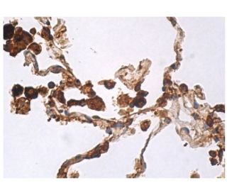 Anti-SP-B Antibody (F-2) | SCBT - Santa Cruz Biotechnology