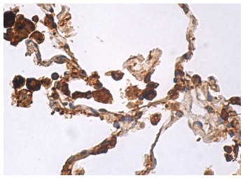 Anti-SP-B Antibody (F-2) | SCBT - Santa Cruz Biotechnology