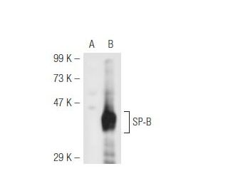 SP-B Antibody (F-2) - Western Blotting - Image 49471