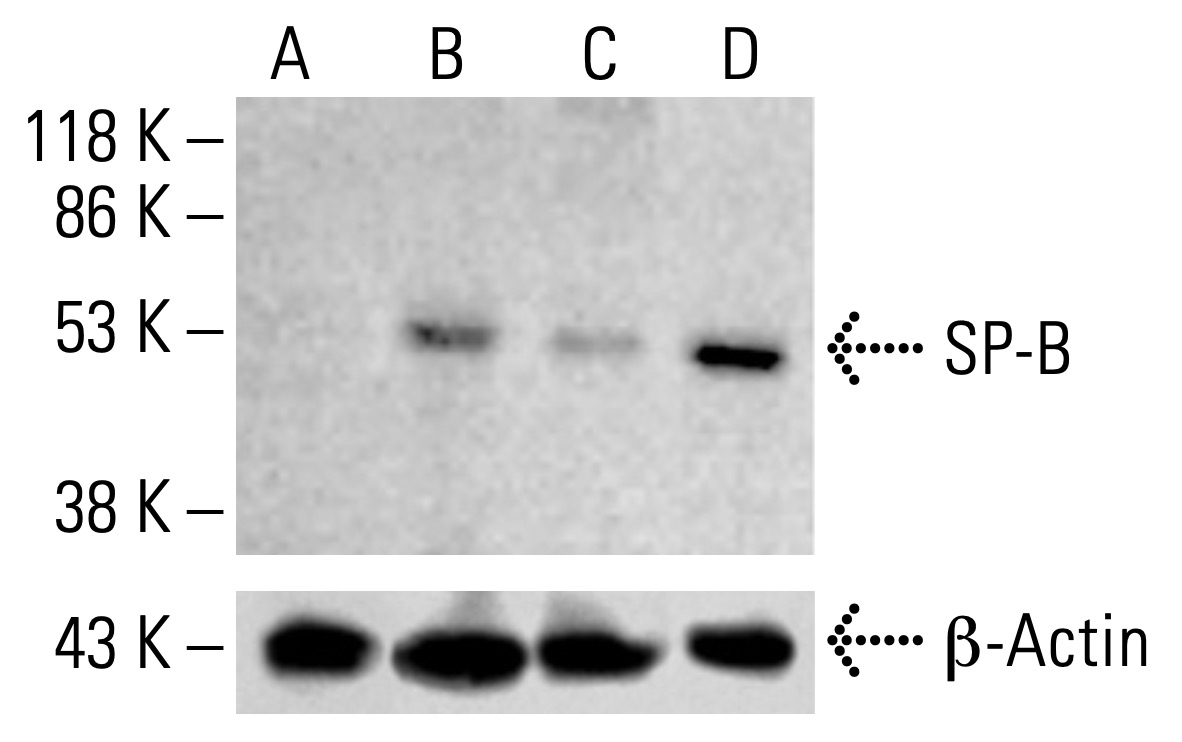 アナトミー 2 SP-B抗体(F-2) | SCBT - Santa Cruz Biotechnology