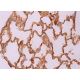 immunohistochemistry image from recommended SP-B (F-2) monoclonal antibody replacement. Image 370273