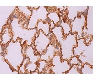 immunohistochemistry image from recommended SP-B (F-2) monoclonal antibody replacement. Image 370273
