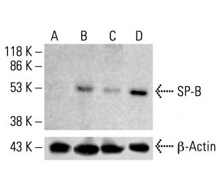 SP-B Antibody (F-2) - Western Blotting - Image 412821