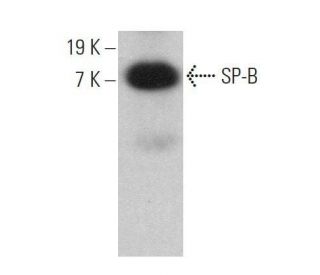 SP-B Antibody (F-2) - Western Blotting - Image 359704Each CRISPR/Cas9 Knockout (KO) Plasmid product consists of a pool of 3 plasmids designed to ensure identification and cleavage of a specific gene for maximum knockout efficiency. Each plasmid encodes a unique 20 nt sequence derived from the GeCKO (v2) library.