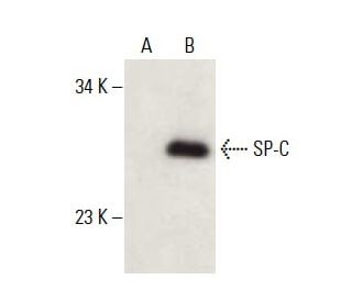 western blotting image from recommended surfactant protein c/SP-C (H-8) monoclonal antibody replacement. Image 397940