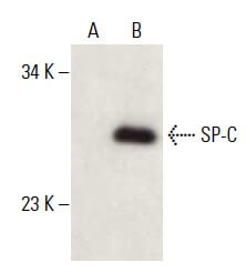 SP-C Antibody (FL-197) | SCBT - Santa Cruz Biotechnology