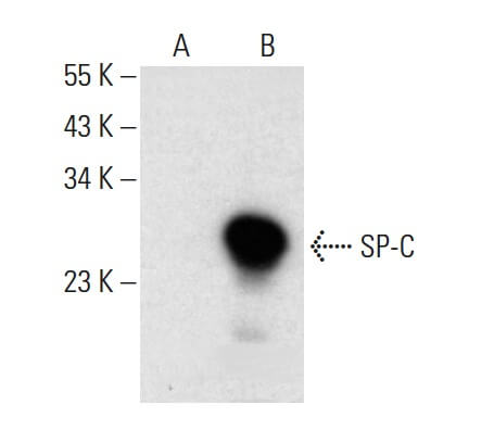 Anti-Prosurfactant Protein C (proSP-C) Antibody