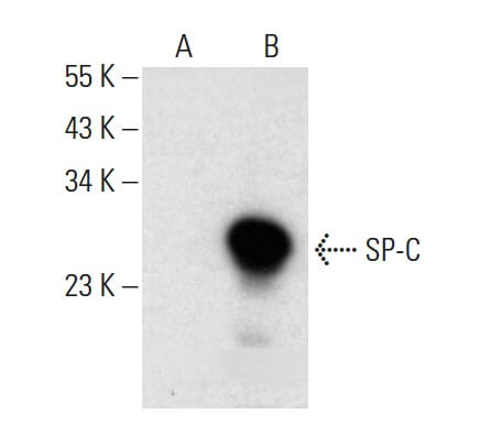 surfactant protein c/SP-C Antibody (H-8): m-IgGκ BP-HRP Bundle