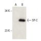 surfactant protein c/SP-C Antibody (H-8) - Western Blotting - Image 397940 