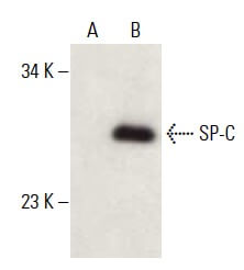 Anti-Prosurfactant Protein C (proSP-C) Antibody