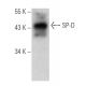 SP-D Antibody (10H11) - Western Blotting - Image 11602