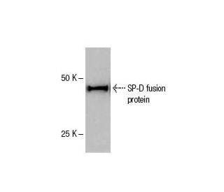 SP-D Antibody (1A10A9) - Western Blotting - Image 47841