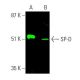 western blotting image from recommended SP-D (C-6) monoclonal antibody replacement. Image 386216