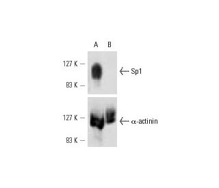 Sp1 siRNA (h): sc-29487. Western blot analysis of Sp1 expression in non-transfected control (A) and Sp1 siRNA transfected 