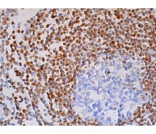Sp110 Antibody (B-10) - Immunohistochemistry - Image 391616 