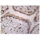 immunohistochemistry image from recommended Sp3 (G-7) monoclonal antibody replacement. Image 160297