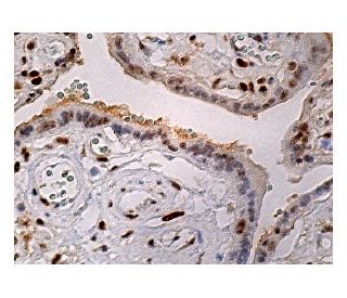 immunohistochemistry image from recommended Sp3 (G-7) monoclonal antibody replacement. Image 160297