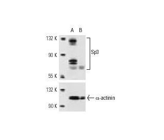 Sp3 siRNA (h): sc-29490. Western blot analysis of Sp3 expression in non-transfected control (A) and Sp3 siRNA transfected 