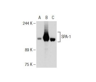 SPA-1 Antibody (3) - Western Blotting - Image 109073 