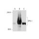 SPA-1 Antibody (3) - Western Blotting - Image 128448