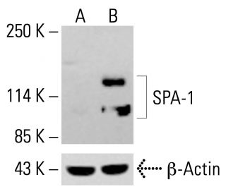 SPA-1 Antibody (C-1) - Western Blotting - Image 413458 