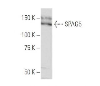 SPAG5 Antibody (LX-8) - Western Blotting - Image 34256SAM Transcription Activation: SAM system utilizing dCas9-VP64, MS2-P65-HSF1, and sgRNA for precise gene transcription activation.
