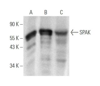 SPAK Antibody (430CT4.4.1) - Western Blotting - Image 374590SAM Transcription Activation: SAM system utilizing dCas9-VP64, MS2-P65-HSF1, and sgRNA for precise gene transcription activation.