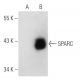 SPARC Antibody (AON-5031) - Western Blotting - Image 37046