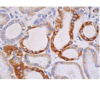 immunohistochemistry image from recommended SPARC (D-2) monoclonal antibody replacement. Image 370159