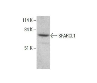 SPARCL1 Antibody (F-8) - Western Blotting - Image 351883 