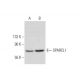 SPARCL1 Antibody (G-5) - Western Blotting - Image 318047 