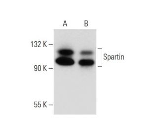 Spartin Antibody (D-4) - Western Blotting - Image 137697 