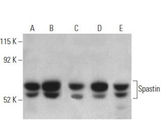 Spastin Antibody (Sp 3G11/1) - Western Blotting - Image 398870 