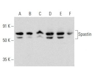 Spastin Antibody (Sp 6C6) - Western Blotting - Image 357266 