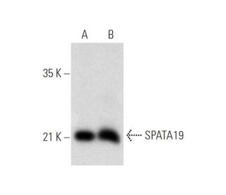 SPATA19抗体 (B-9) | SCBT - Santa Cruz Biotechnology