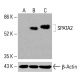 MCPIP 抗体 (H-6):sc-515275。Western blot 分析未处理(A)和化学处理(B)的 HCT-116 完整细胞裂解物中的 MCPIP 表达。使用的检测试剂:m-IgGκ BP-HRP:sc -516102。β-肌动蛋白(C4):sc-47778用作加载对照。使用的检测试剂:m-IgG Fc BP-HRP:sc-525409。 SPATA2 Antibody (B-7) - Western Blotting - Image 415974