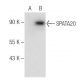 SPATA20 Antibody (D-3) - Western Blotting - Image 145597