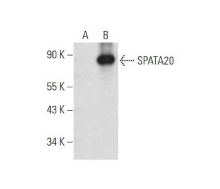 SPATA20 Antibody (H-10) - Western Blotting - Image 344469