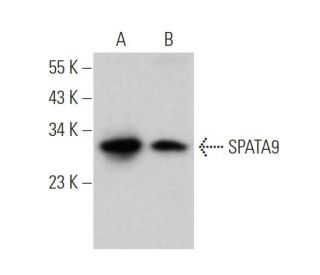 SPATA9 Antibody (F-6) - Western Blotting - Image 374393 