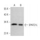 SPATC1L Antibody (C-4) - Western Blotting - Image 379399 
