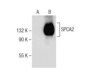 SPCA1/2 Antibody (B-3) - Western Blotting - Image 283635