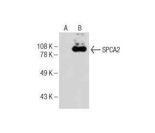 SPCA2 Antibody (C-9) - Western Blotting - Image 160614