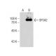 SPCA2 Antibody (C-9) - Western Blotting - Image 160614