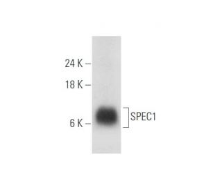 SPEC1 Antibody (E-2) - Western Blotting - Image 333660SAM Transcription Activation: SAM system utilizing dCas9-VP64, MS2-P65-HSF1, and sgRNA for precise gene transcription activation.